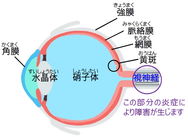 抗がん剤治療と眼の症状2